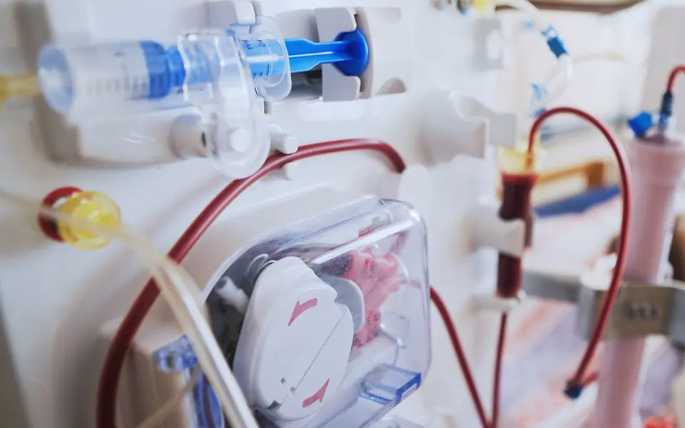 Bloodline tubes with hemodialysis machine in the background. Health care, blood purification, kidney failure, transplantation.