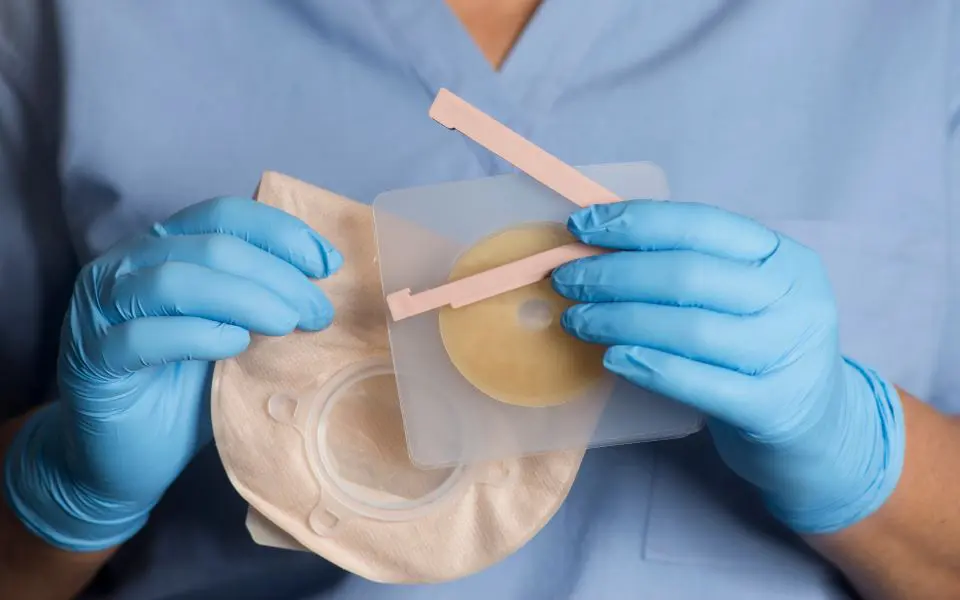 Nurse in blue gloves holding an ostomy bag used in wound care and skilled nursing