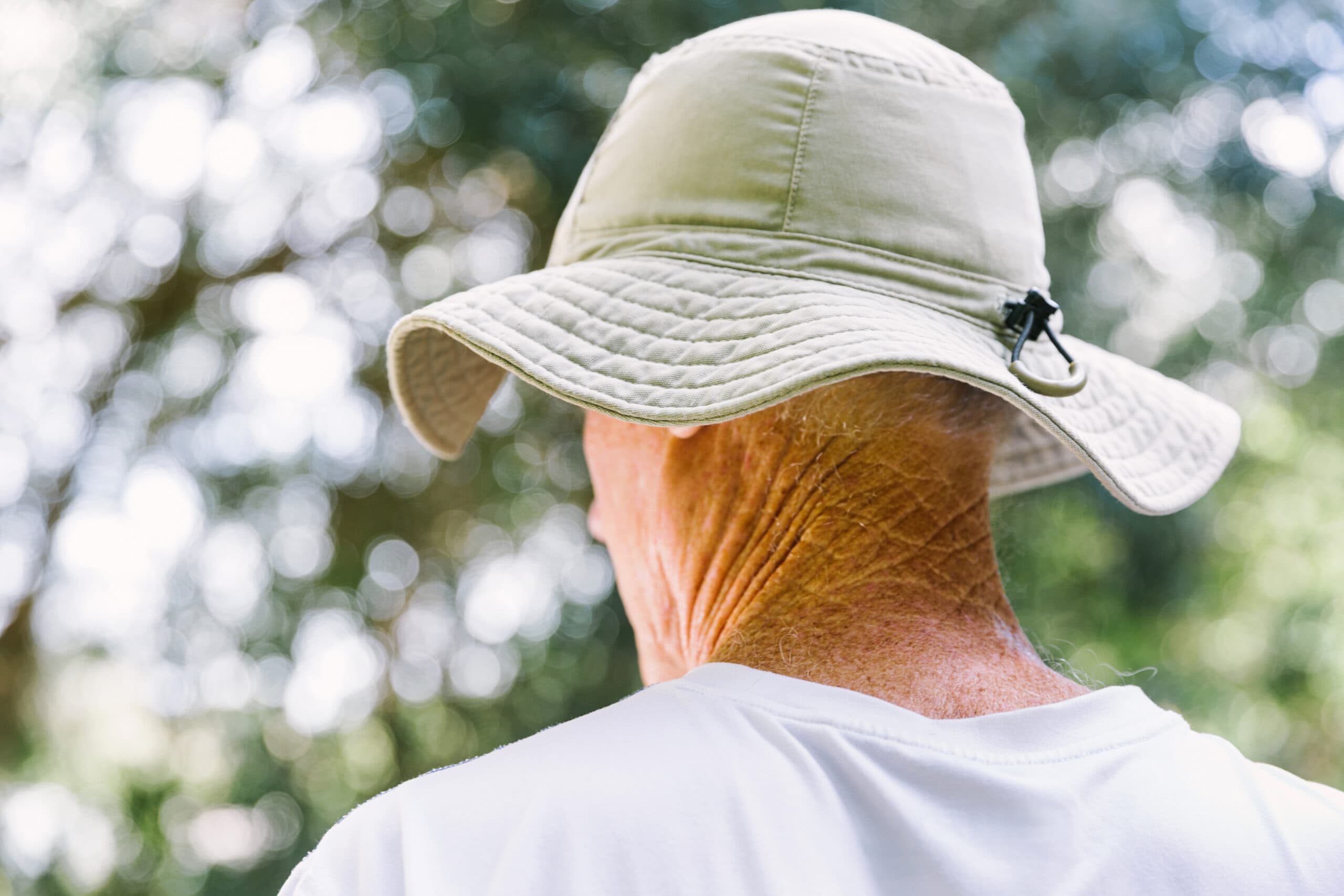 aging-skin-old-man